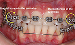 Can asymmetries in the smile be corrected with Orthodontics?