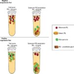 Schematic representation of macroprolactin testing using polyethylene glycol (PEG) in samples with and without macroprolactinemia. - SciELO in Perspective | Press Releases Schematic representation of macroprolactin testing using polyethylene glycol (PEG) in samples with and without macroprolactinemia.