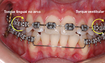 Assimetrias no sorriso podem ser corrigidas com Ortodontia?
