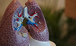 Identificação de características prognósticas da sarcoidose pulmonar permite predizer seu desenvolvimento